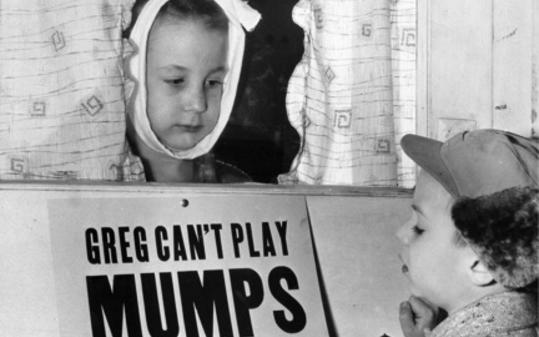Permalink to Mumps Making the Rounds…In the Vaccinated…Again