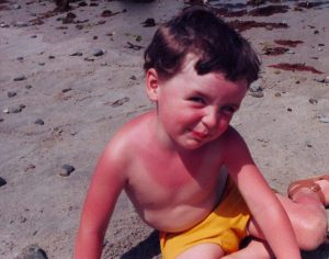 sunburn-child