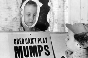 mumps